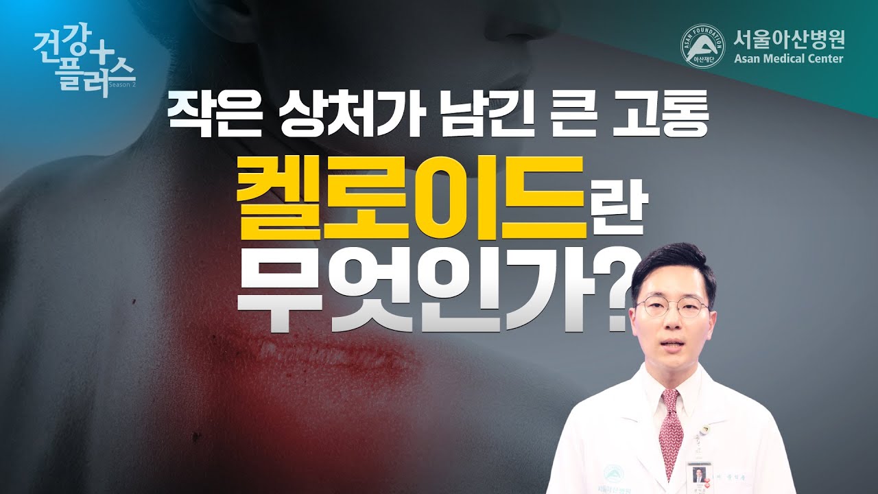 [건강플러스]작은 상처가 남긴 큰 고통, '켈로이드'