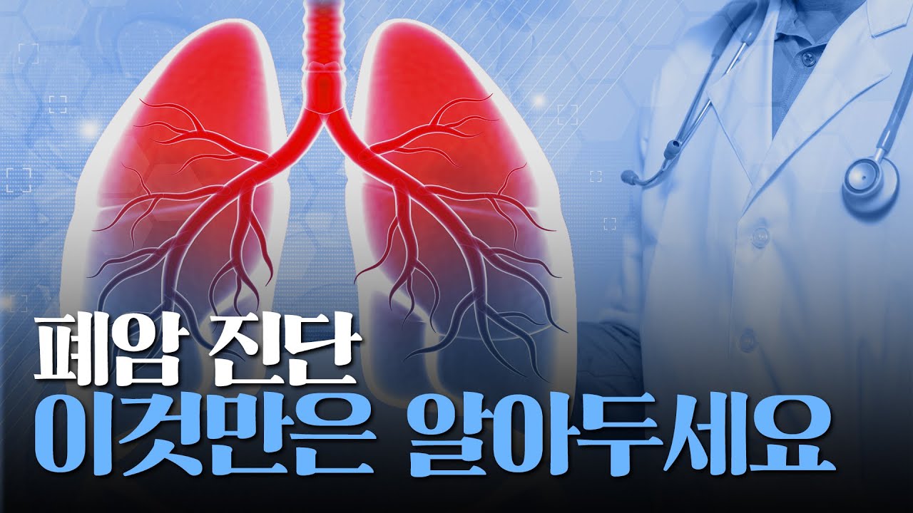 [암행의사]폐암 Q&A 완전정리, 진단 전 꼭 알아야 할 모든 것!