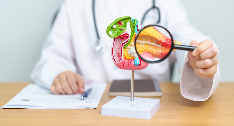 췌장암 치료 좌우하는 ‘섬유아세포 아형 구분’ 성공