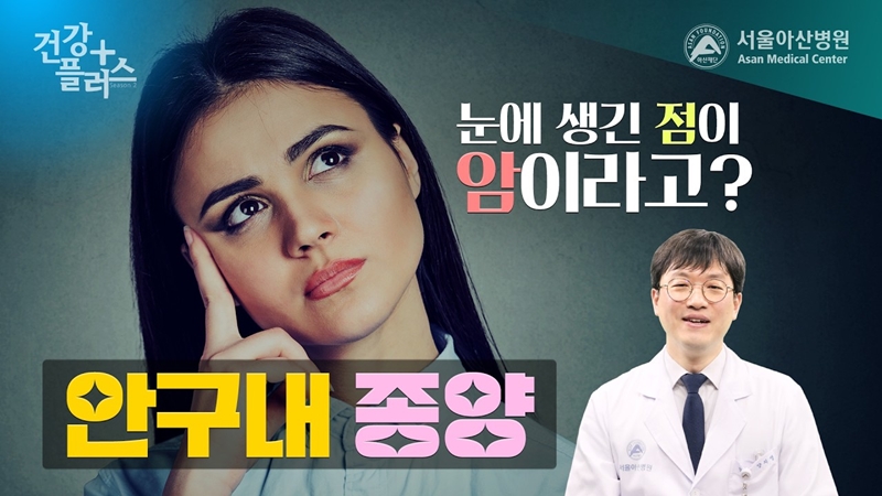 [건강플러스] 안구내 종양,<br> 눈에 생긴 점이 암이라고?