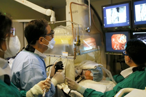 Novel Anti Migration Stent Reduces Repeat Procedures for Pediatric Pancreatic Duct Strictures