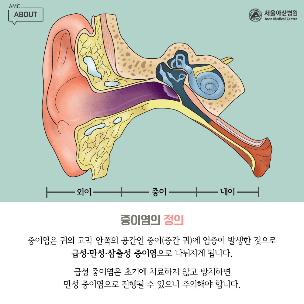 흔하게 발생하는 귀 질환, 중이염과 이명 | 건강 정보 | 헬스 | 서울아산병원 뉴스룸